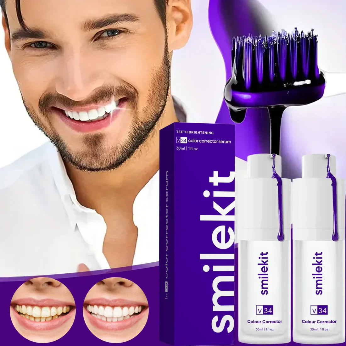 Crema Blanqueadora SmileKit | Sonrisa Radiante en Minutos