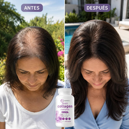 Multi Collagen | Piel firme y cabello radiante en semanas
